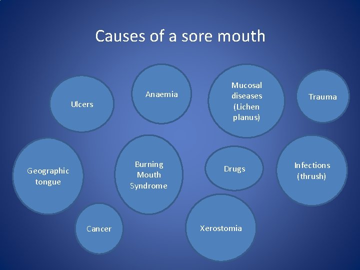 Causes of a sore mouth Ulcers Anaemia Burning Mouth Syndrome Geographic tongue Cancer Mucosal