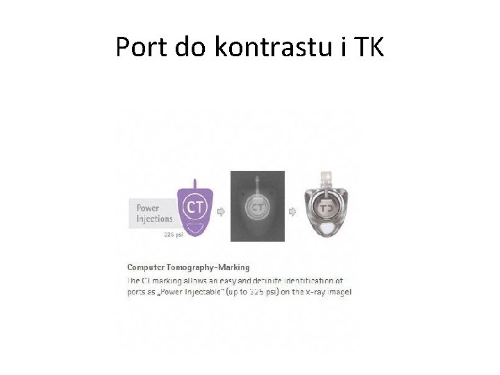 Port do kontrastu i TK 