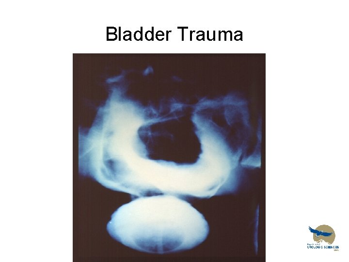 Bladder Trauma 