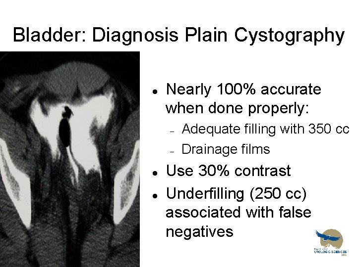 Bladder: Diagnosis Plain Cystography l Nearly 100% accurate when done properly: – – l