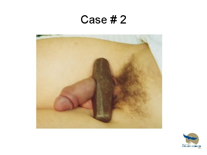 Case # 2 
