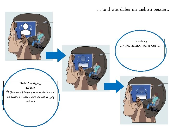 … und was dabei im Gehirn passiert. Entstehung der SMA (Sensomotorische Amnesie) Starke Ausprägung