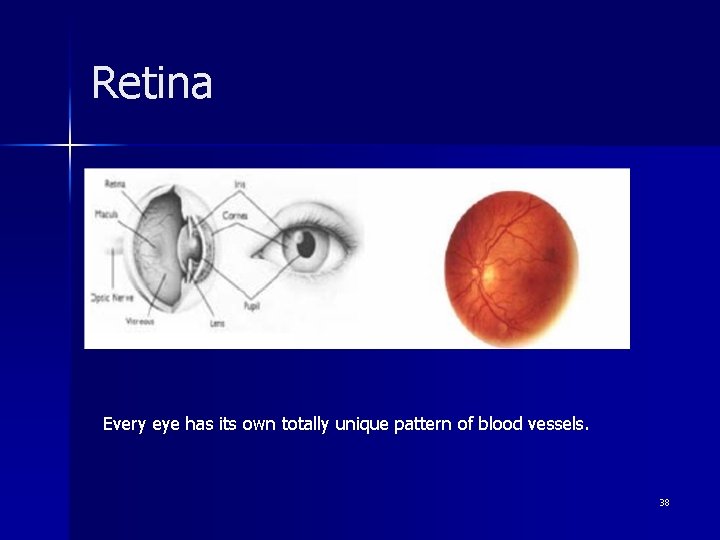 Retina Every eye has its own totally unique pattern of blood vessels. 38 