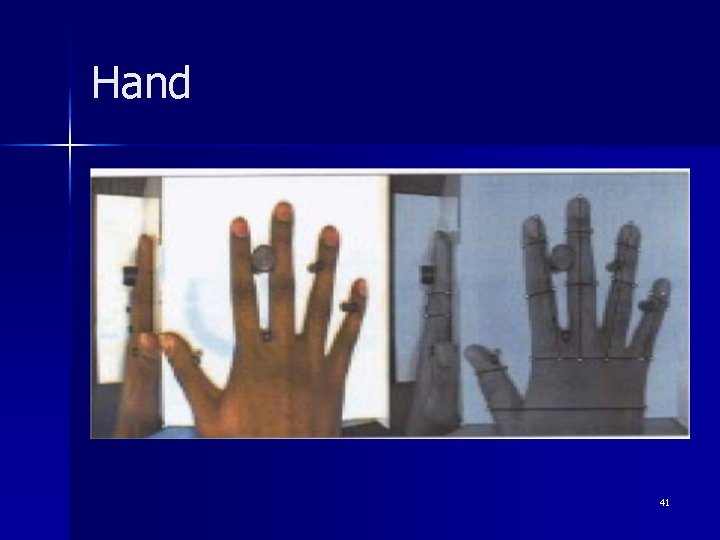 Hand 41 