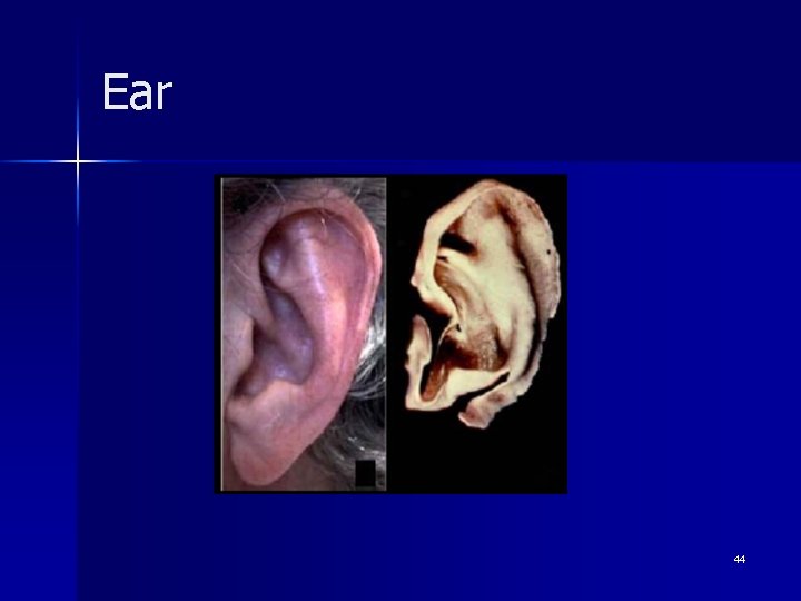 Ear 44 