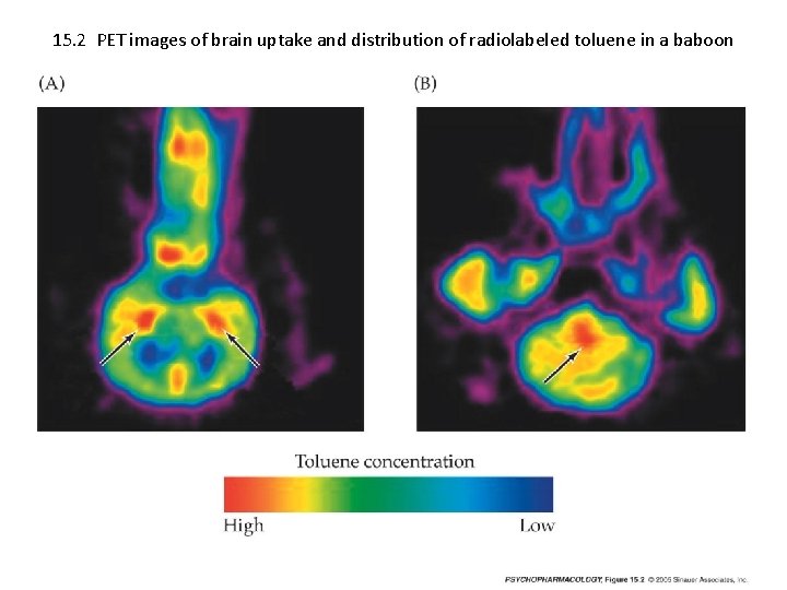 15. 2 PET images of brain uptake and distribution of radiolabeled toluene in a