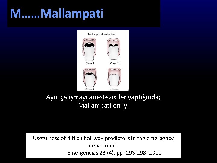 M……Mallampati Aynı çalışmayı anestezistler yaptığında; Mallampati en iyi Usefulness of difficult airway predictors in