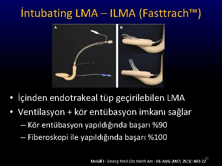 İntubating LMA – ILMA (Fasttrach™) • İçinden endotrakeal tüp geçirilebilen LMA • Ventilasyon +