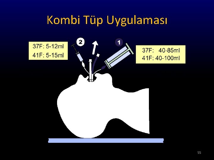 Kombi Tüp Uygulaması Emergency: No. 2: 10 ml No. 1: 85 ml (or more)