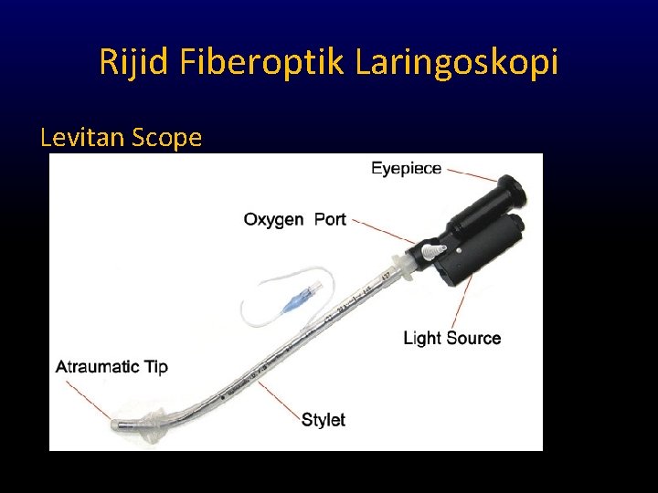Rijid Fiberoptik Laringoskopi Levitan Scope 