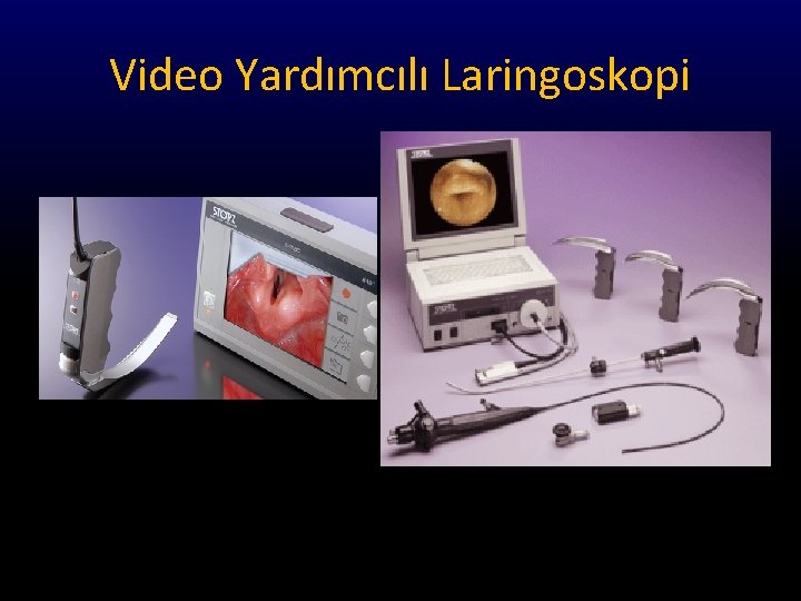 Video Yardımcılı Laringoskopi 