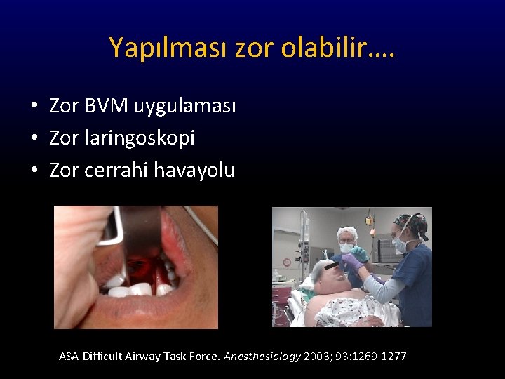 Yapılması zor olabilir…. • Zor BVM uygulaması • Zor laringoskopi • Zor cerrahi havayolu