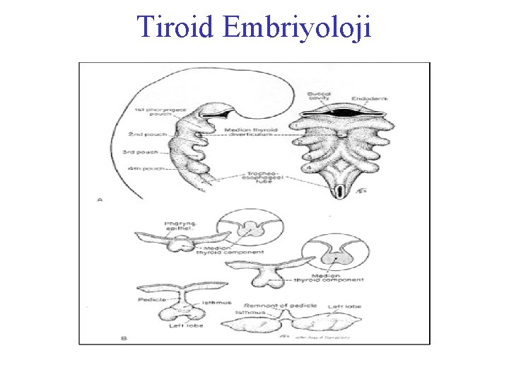 Tiroid Embriyoloji 