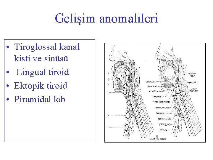 Gelişim anomalileri • Tiroglossal kanal kisti ve sinüsü • Lingual tiroid • Ektopik tiroid