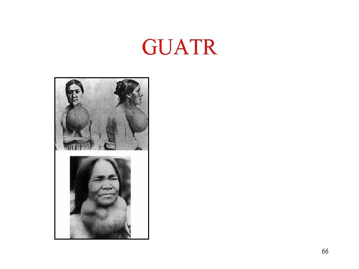 GUATR 66 