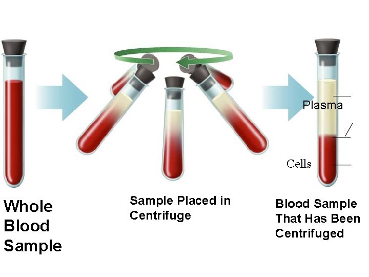 Plasma Cells Whole Blood Sample Placed in Centrifuge Blood Sample That Has Been Centrifuged