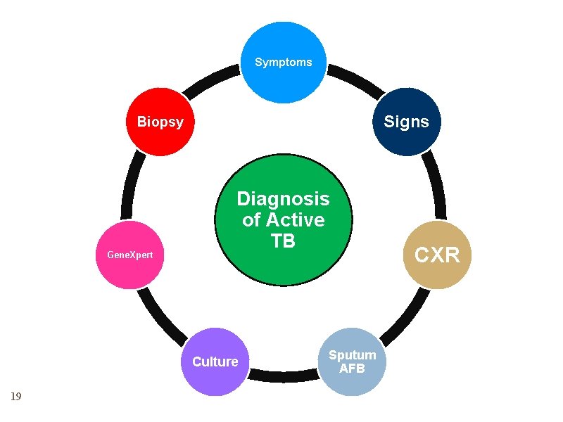 Symptoms Signs Biopsy Gene. Xpert Diagnosis of Active TB Culture 19 Sputum AFB CXR