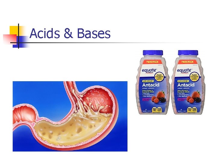 Acids & Bases 
