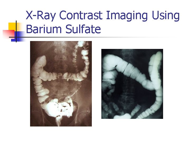 X-Ray Contrast Imaging Using Barium Sulfate 