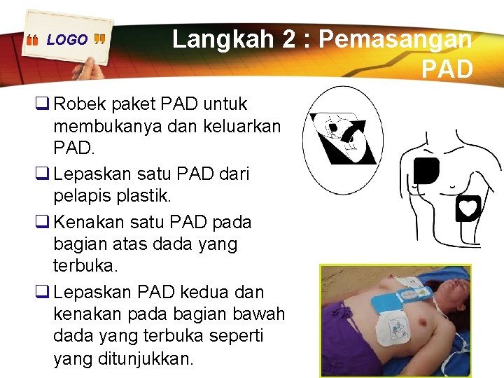 LOGO Langkah 2 : Pemasangan PAD q Robek paket PAD untuk membukanya dan keluarkan