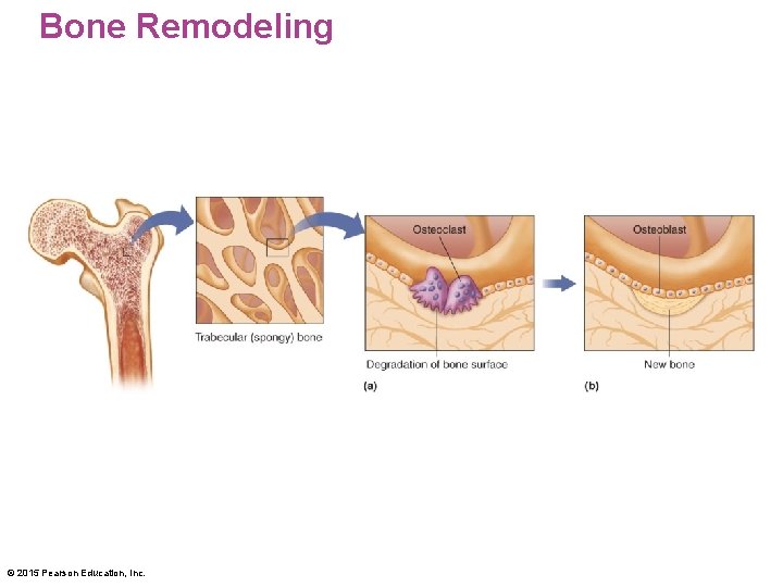 Bone Remodeling © 2015 Pearson Education, Inc. 