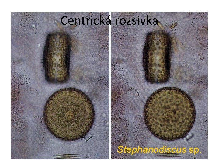 Centrická rozsivka Stephanodiscus sp. 