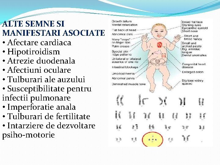 ALTE SEMNE SI MANIFESTARI ASOCIATE • Afectare cardiaca • Hipotiroidism • Atrezie duodenala •