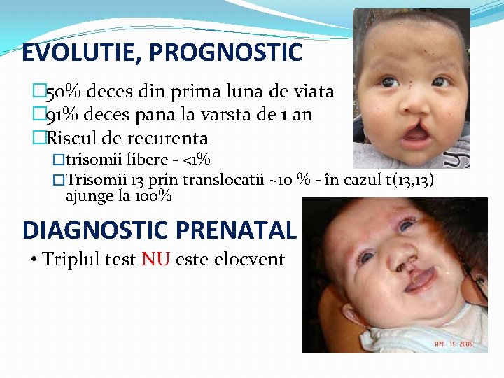 EVOLUTIE, PROGNOSTIC � 50% deces din prima luna de viata � 91% deces pana