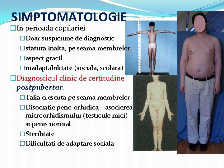 SIMPTOMATOLOGIE �In perioada copilariei �Doar suspiciune de diagnostic �statura inalta, pe seama membrelor �aspect