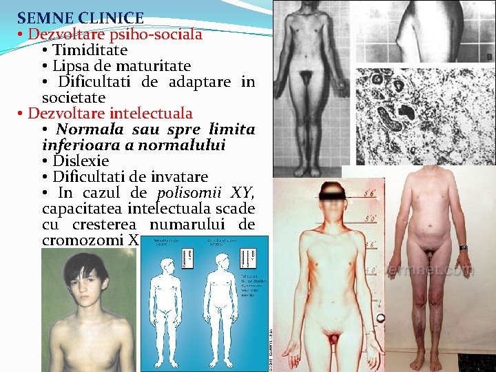 SEMNE CLINICE • Dezvoltare psiho-sociala • Timiditate • Lipsa de maturitate • Dificultati de