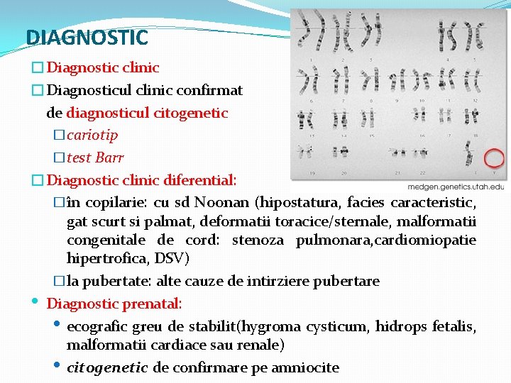 DIAGNOSTIC �Diagnostic clinic �Diagnosticul clinic confirmat de diagnosticul citogenetic �cariotip �test Barr �Diagnostic clinic