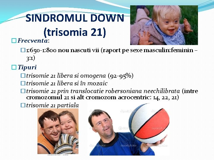 SINDROMUL DOWN (trisomia 21) �Frecventa: � 1: 650 -1: 800 nou nascuti vii (raport