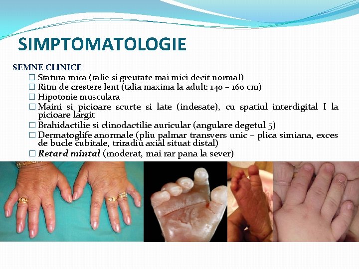 SIMPTOMATOLOGIE SEMNE CLINICE � Statura mica (talie si greutate mai mici decit normal) �
