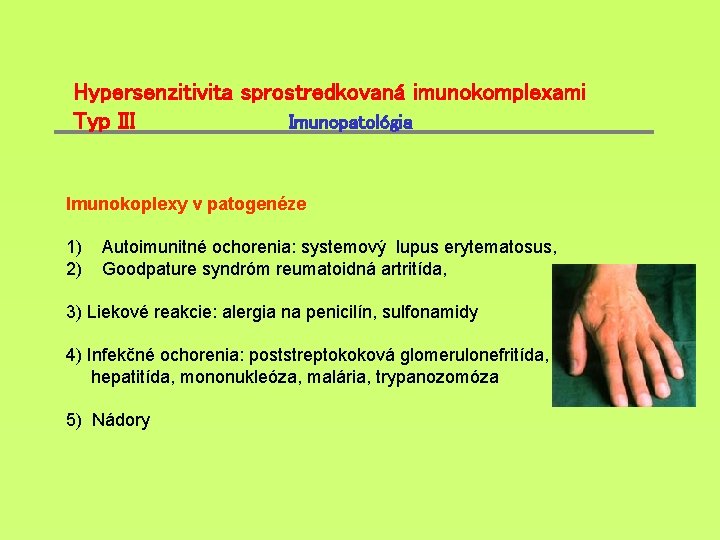 Hypersenzitivita sprostredkovaná imunokomplexami Typ III Imunopatológia Imunokoplexy v patogenéze 1) 2) Autoimunitné ochorenia: systemový