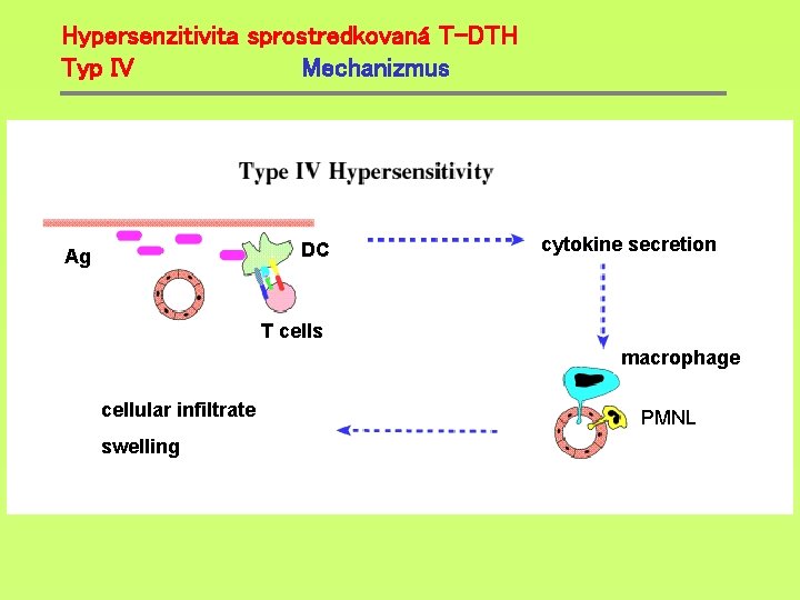 Hypersenzitivita sprostredkovaná T-DTH Typ IV Mechanizmus DC Ag cytokine secretion T cells macrophage cellular