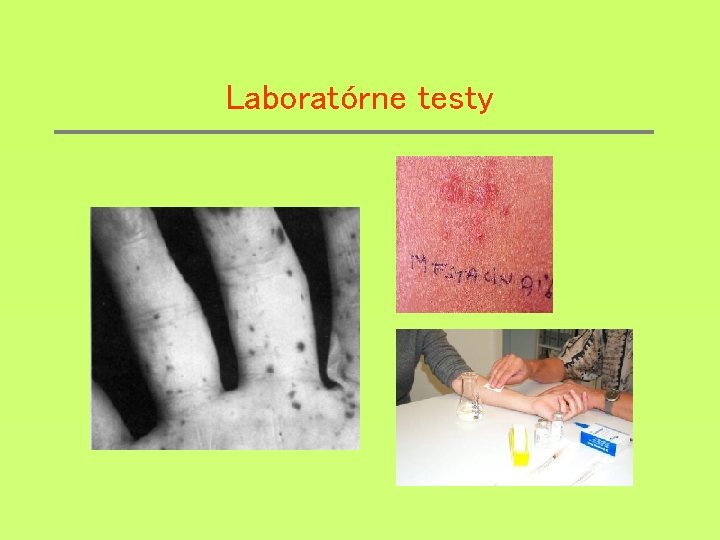 Laboratórne testy 