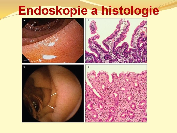 Endoskopie a histologie 