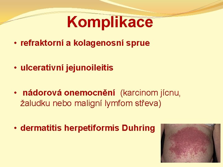 Komplikace • refraktorní a kolagenosní sprue • ulcerativní jejunoileitis • nádorová onemocnění (karcinom jícnu,