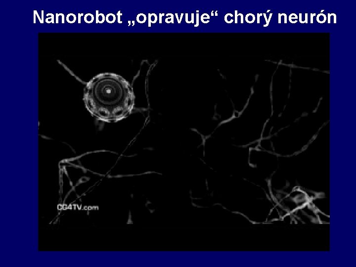 Nanorobot „opravuje“ chorý neurón 