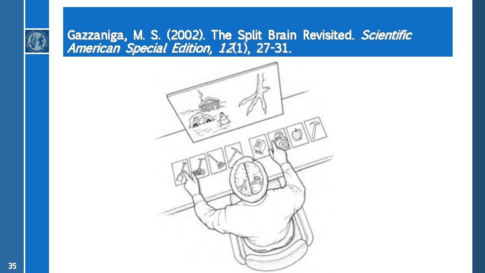 Gazzaniga, M. S. (2002). The Split Brain Revisited. Scientific American Special Edition, 12(1), 27