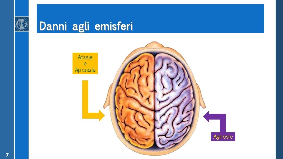 Danni agli emisferi Afasie e Aprassie Agnosie 7 