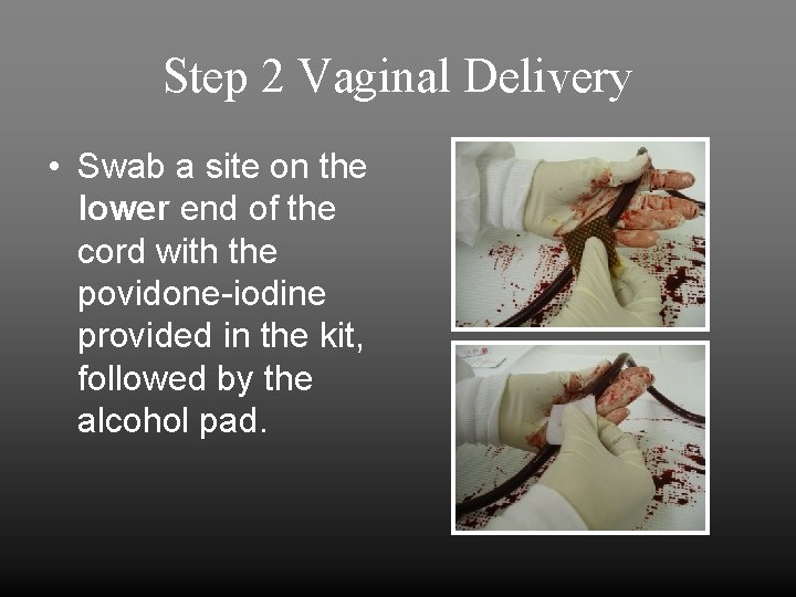 Step 2 Vaginal Delivery • Swab a site on the lower end of the