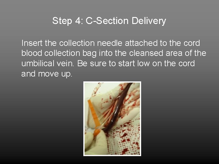 Step 4: C-Section Delivery Insert the collection needle attached to the cord blood collection