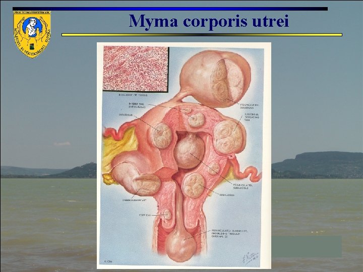 Myma corporis utrei 