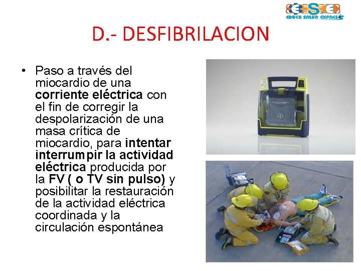 D. - DESFIBRILACION • Paso a través del miocardio de una corriente eléctrica con