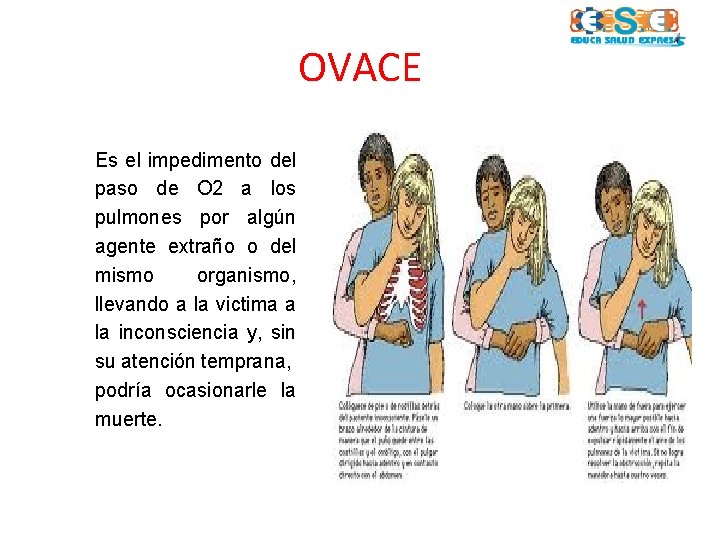 OVACE Es el impedimento del paso de O 2 a los pulmones por algún