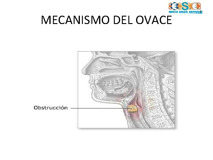 MECANISMO DEL OVACE 