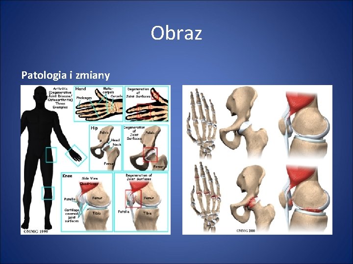 Obraz Patologia i zmiany 