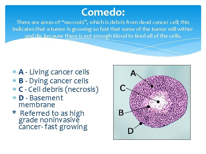 Comedo: There areas of “necrosis”, which is debris from dead cancer cell; this indicates