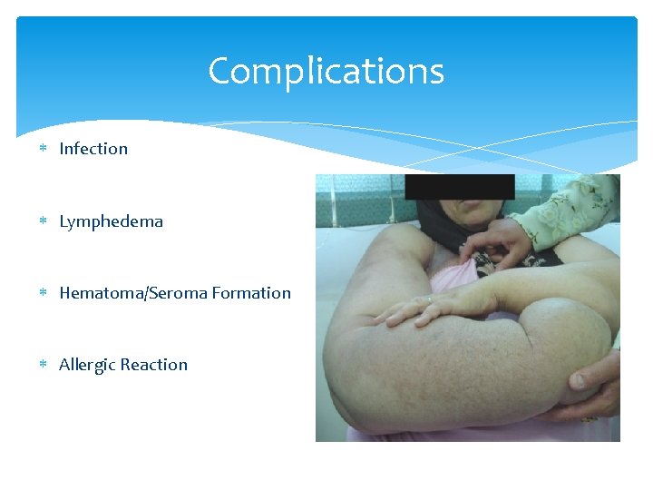 Complications Infection Lymphedema Hematoma/Seroma Formation Allergic Reaction 